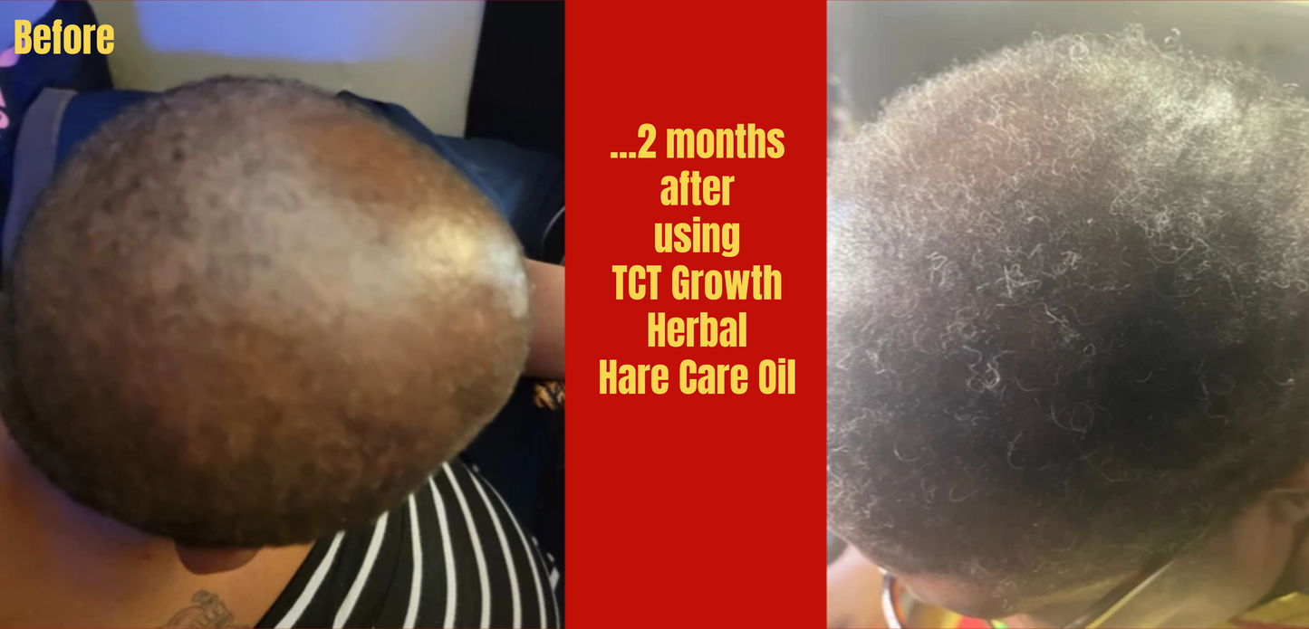 PRE-ORDERS: TCT Growth Herbal Hair Care Oil